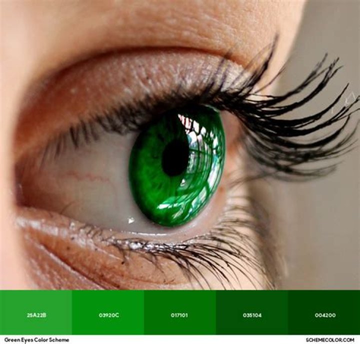 Greenish eye color